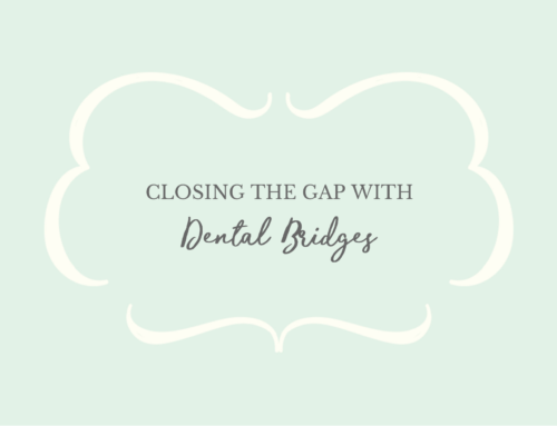 Closing the Gap with Dental Bridges